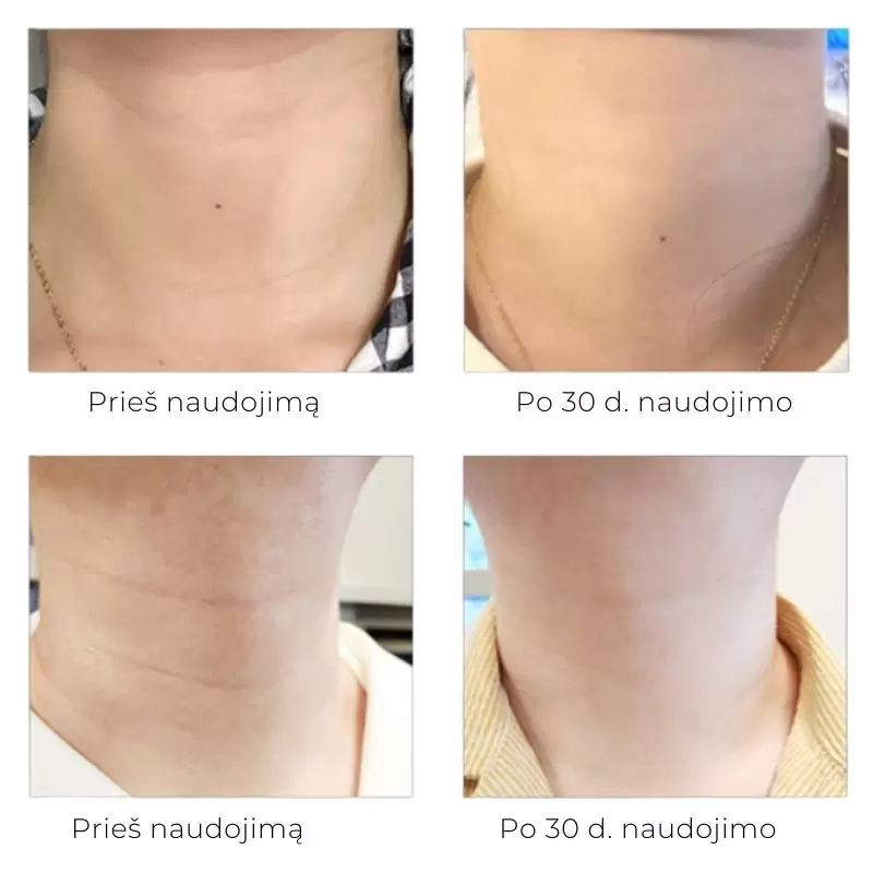 AROCELL kaklo ir dekoltė odos kremas su niacinamidu, 80 g