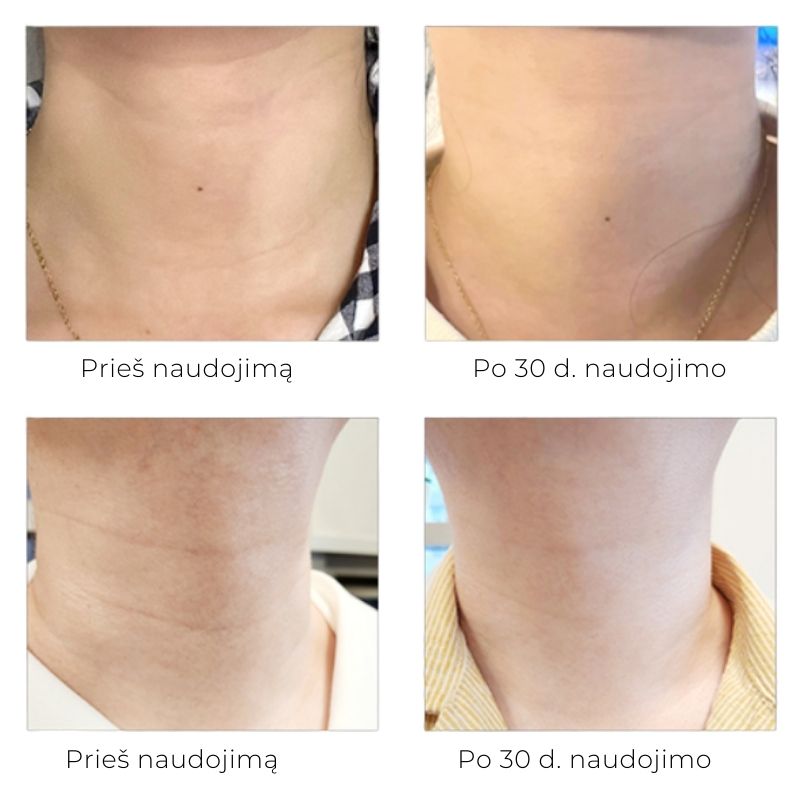 Arocell intensyvaus poveikio kaklo kremas, 80 g